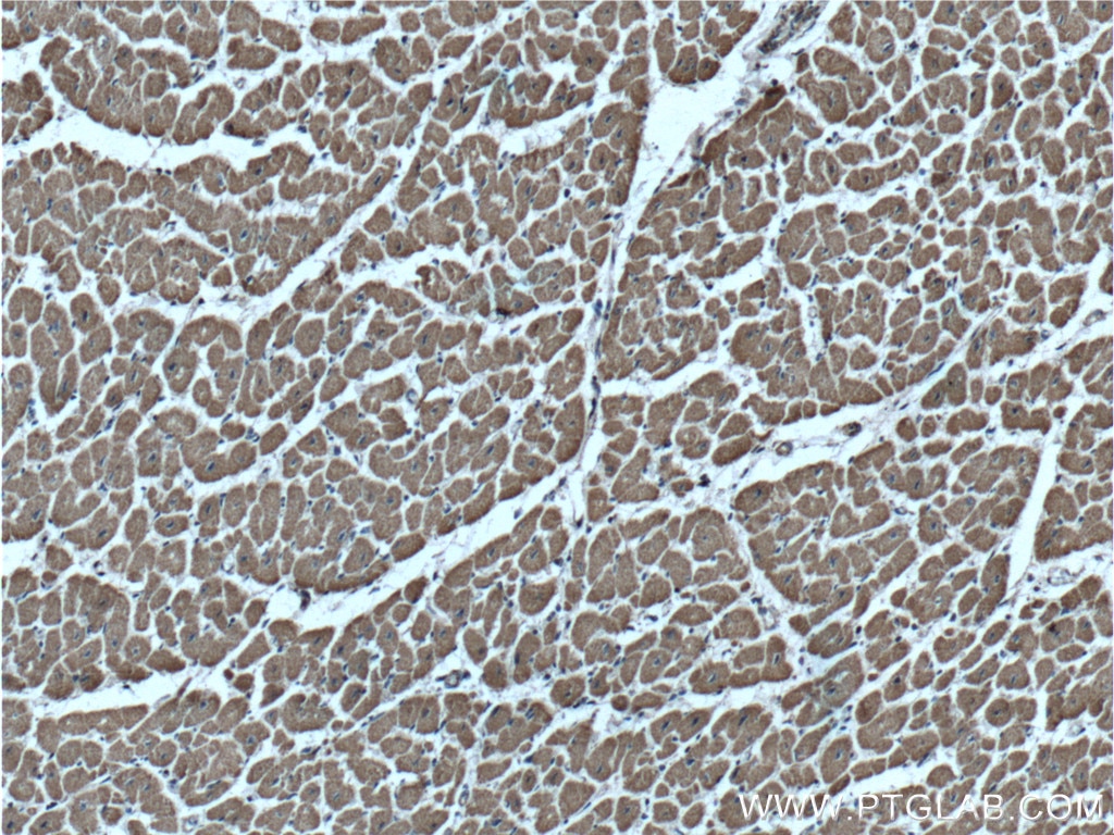 Immunohistochemistry (IHC) staining of human heart tissue using VPS24 Polyclonal antibody (15472-1-AP)