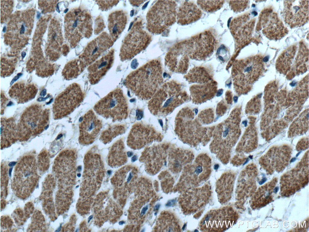 Immunohistochemistry (IHC) staining of human heart tissue using VPS24 Polyclonal antibody (15472-1-AP)