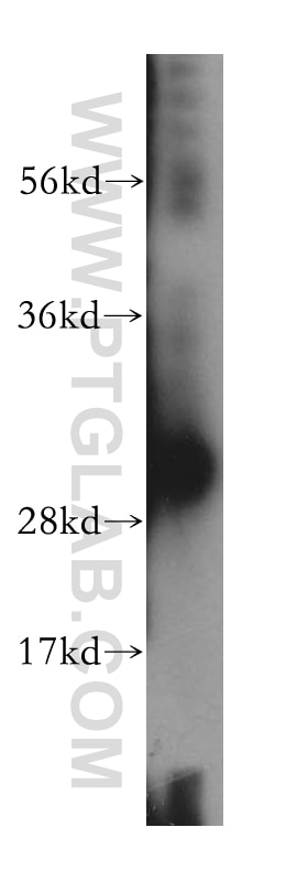 Western Blot (WB) analysis of human kidney tissue using VPS24 Polyclonal antibody (15472-1-AP)