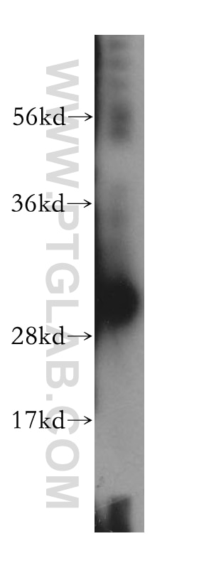 WB analysis of human kidney using 15472-1-AP