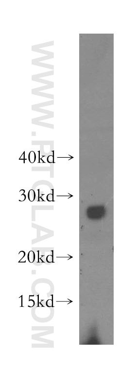 Western Blot (WB) analysis of HEK-293 cells using VPS24 Polyclonal antibody (15472-1-AP)