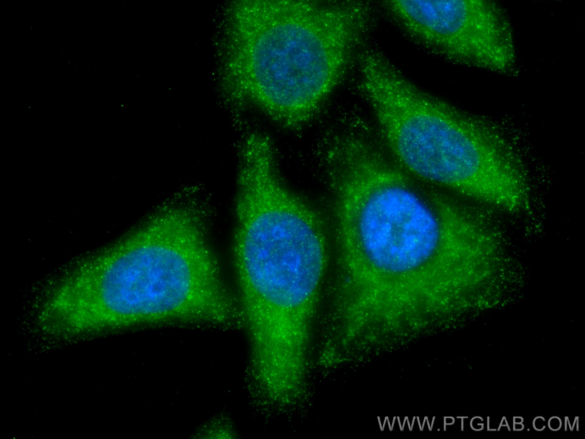 Immunofluorescence (IF) / fluorescent staining of HepG2 cells using VPS25 Polyclonal antibody (15669-1-AP)