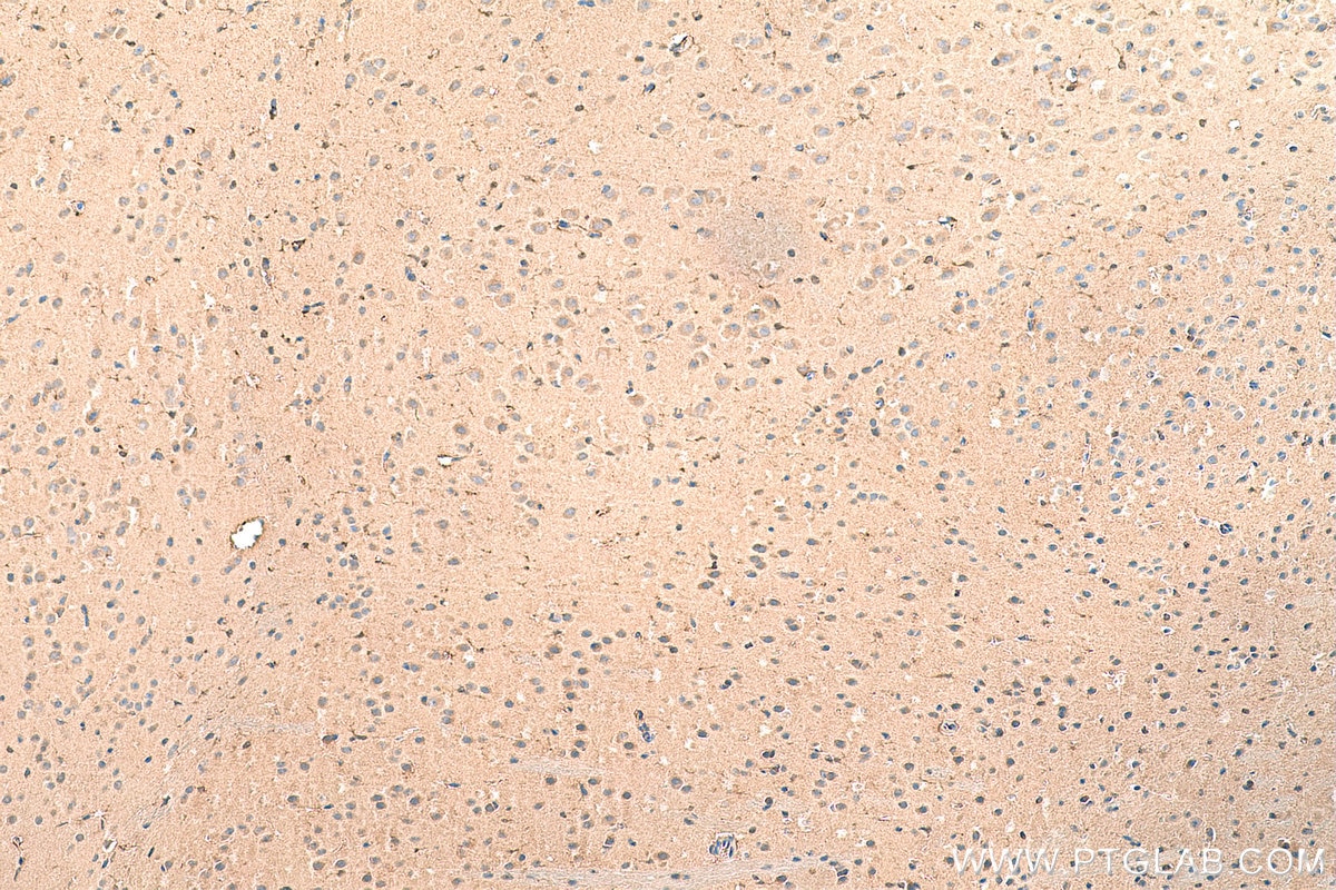 IHC staining of mouse brain using 15669-1-AP