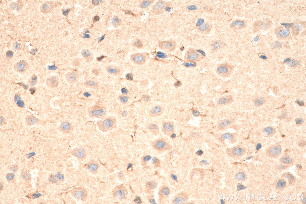 Immunohistochemistry (IHC) staining of mouse brain tissue using VPS25 Polyclonal antibody (15669-1-AP)