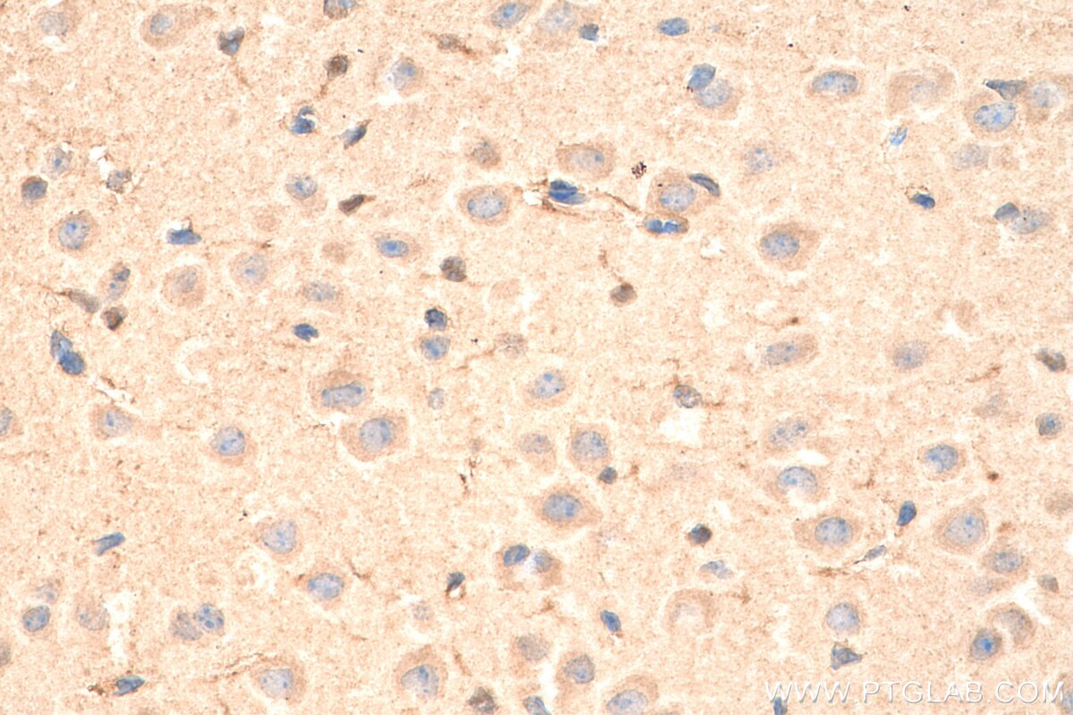 IHC staining of mouse brain using 15669-1-AP