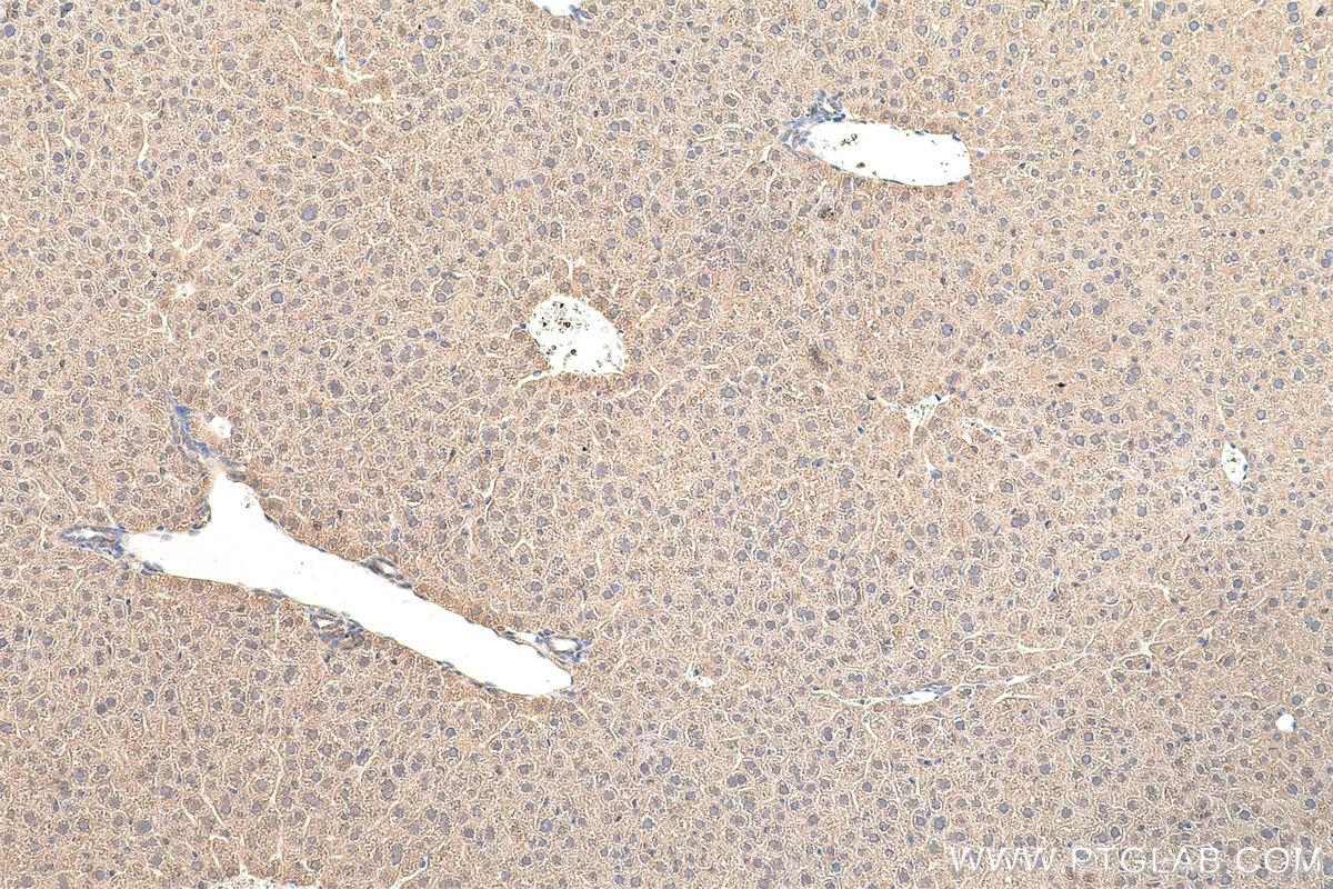 Immunohistochemistry (IHC) staining of mouse liver tissue using VPS25 Polyclonal antibody (15669-1-AP)