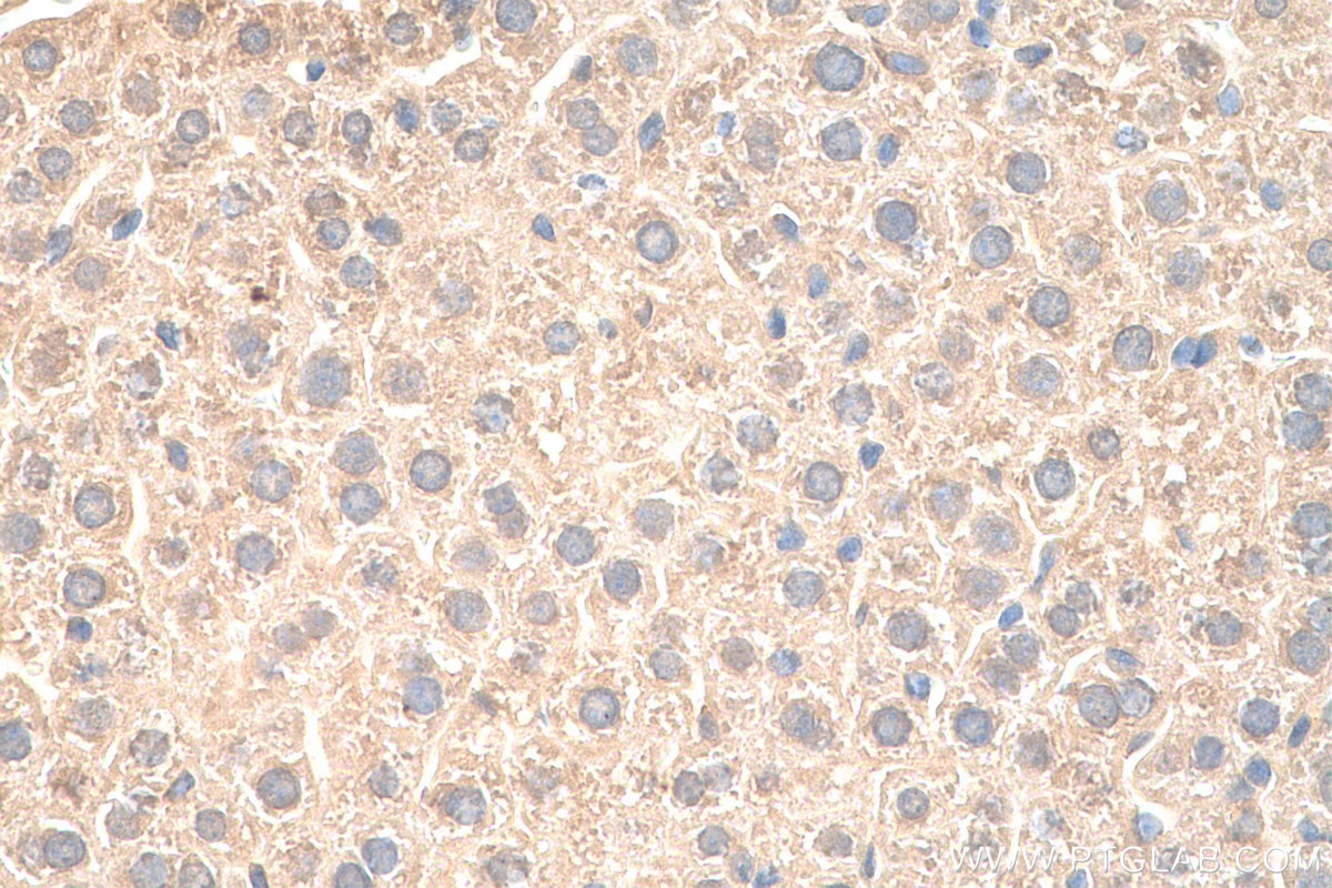 Immunohistochemistry (IHC) staining of mouse liver tissue using VPS25 Polyclonal antibody (15669-1-AP)