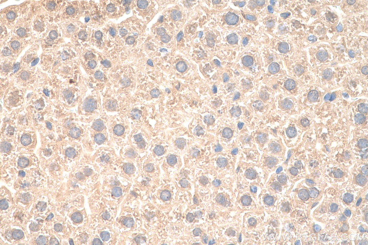 Immunohistochemistry (IHC) staining of mouse liver tissue using VPS25 Polyclonal antibody (15669-1-AP)
