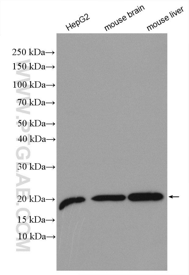 Western Blot (WB) analysis of various lysates using VPS25 Polyclonal antibody (15669-1-AP)