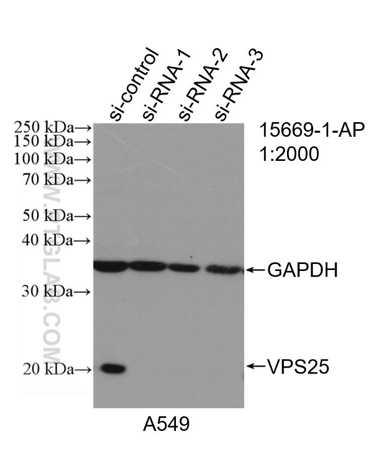 Western Blot (WB) analysis of A549 cells using VPS25 Polyclonal antibody (15669-1-AP)