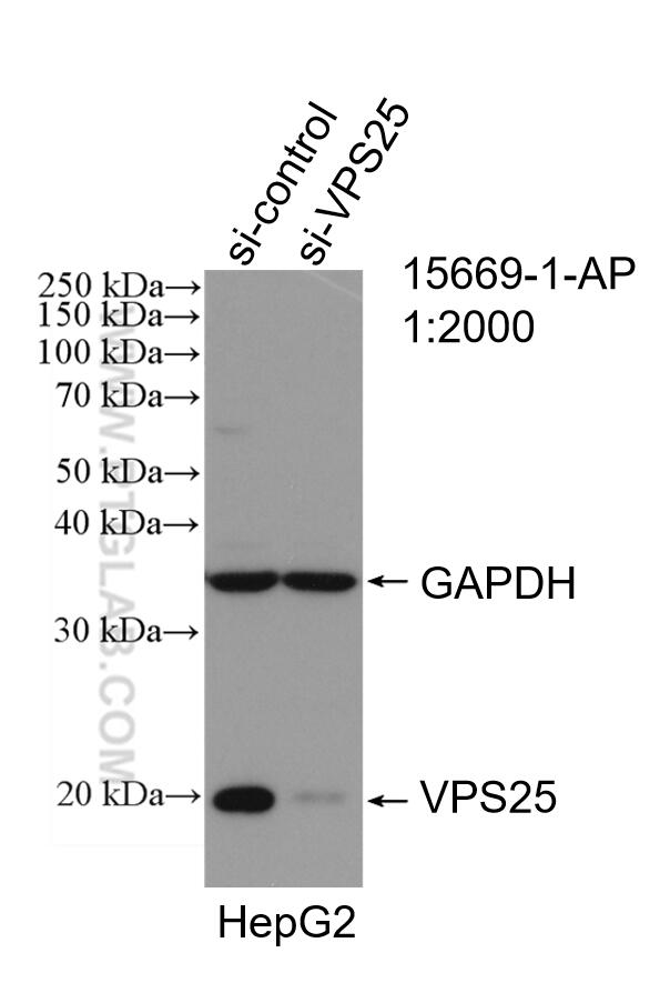 Western Blot (WB) analysis of HepG2 cells using VPS25 Polyclonal antibody (15669-1-AP)