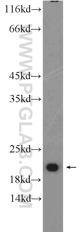 Western Blot (WB) analysis of mouse liver tissue using VPS25 Polyclonal antibody (15669-1-AP)