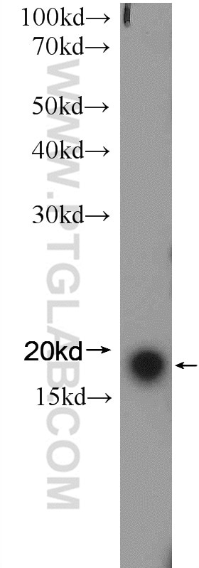 Western Blot (WB) analysis of rat liver tissue using VPS25 Polyclonal antibody (15669-1-AP)