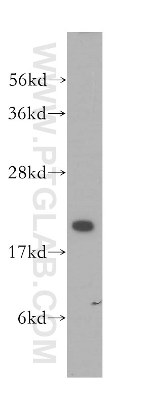 Western Blot (WB) analysis of HeLa cells using VPS25 Polyclonal antibody (15669-1-AP)