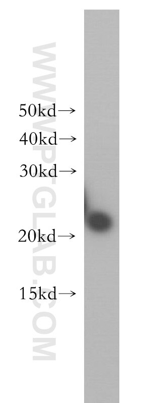 Western Blot (WB) analysis of human brain tissue using VPS25 Polyclonal antibody (15669-1-AP)