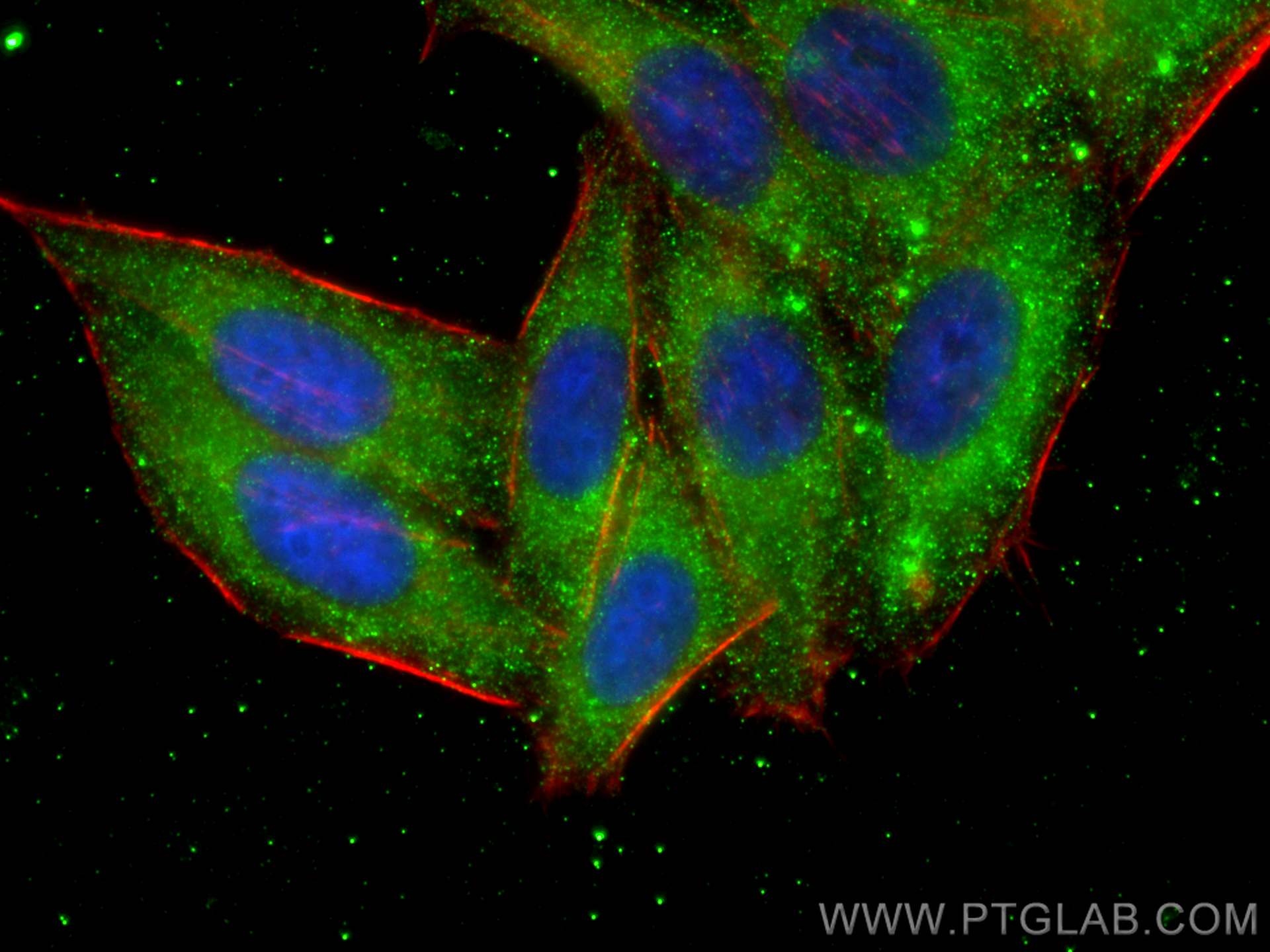 Immunofluorescence (IF) / fluorescent staining of HepG2 cells using VPS25 Monoclonal antibody (68197-1-Ig)
