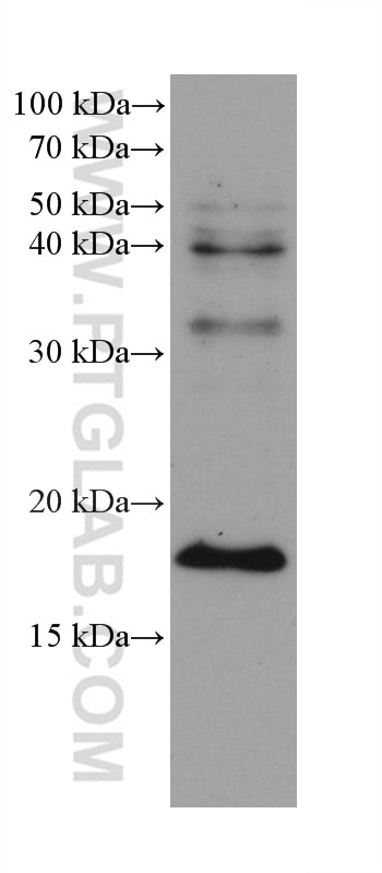 WB analysis of HeLa using 68197-1-Ig