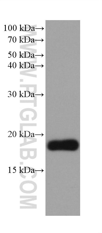 Western Blot (WB) analysis of rabbit kidney tissue using VPS25 Monoclonal antibody (68197-1-Ig)