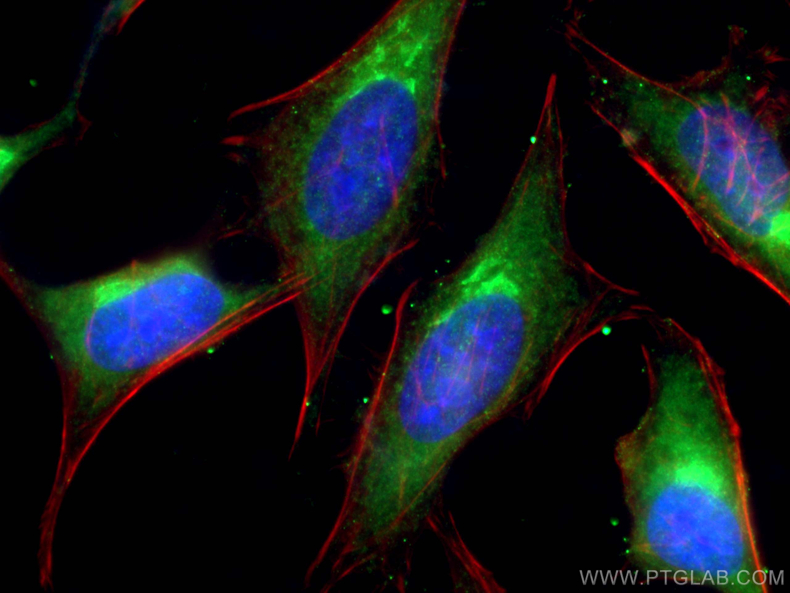 Immunofluorescence (IF) / fluorescent staining of HeLa cells using VPS26A Polyclonal antibody (12804-1-AP)