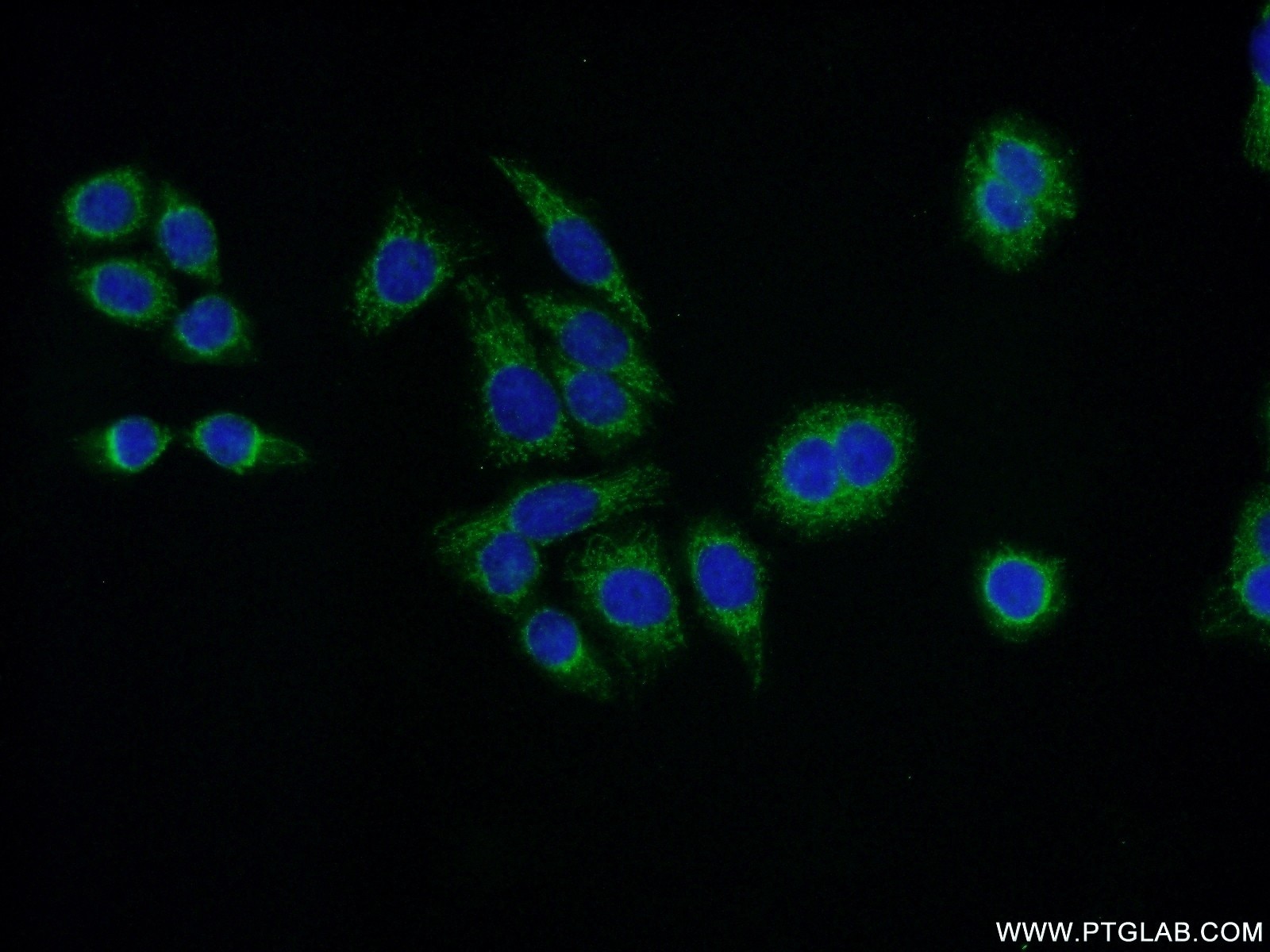 Immunofluorescence (IF) / fluorescent staining of HeLa cells using VPS26A Polyclonal antibody (12804-1-AP)
