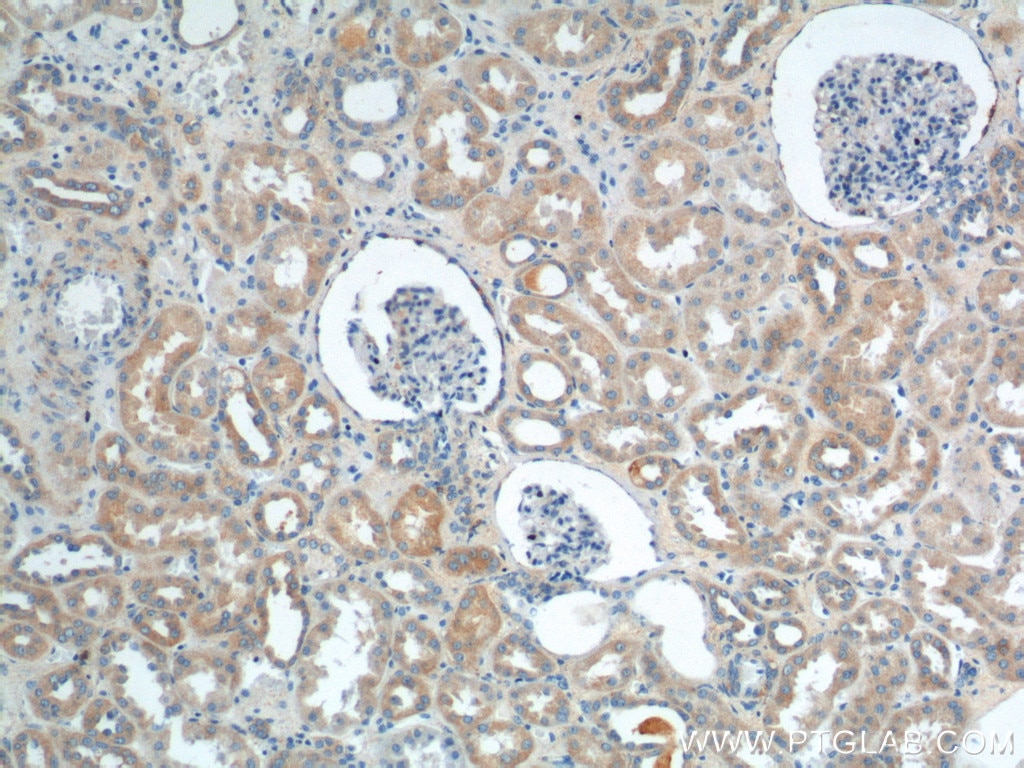Immunohistochemistry (IHC) staining of human kidney tissue using VPS26A Polyclonal antibody (12804-1-AP)