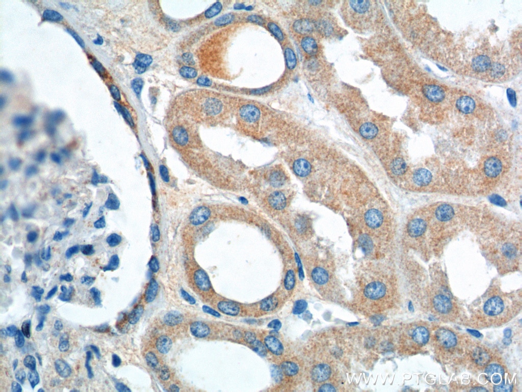 Immunohistochemistry (IHC) staining of human kidney tissue using VPS26A Polyclonal antibody (12804-1-AP)