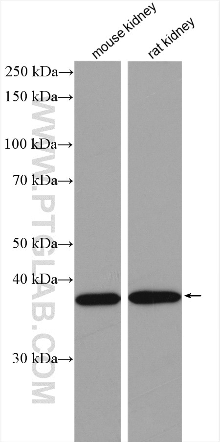 Western Blot (WB) analysis of various lysates using VPS26A Polyclonal antibody (12804-1-AP)