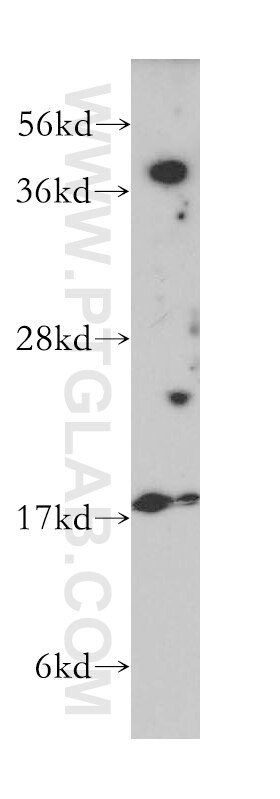 VPS26A