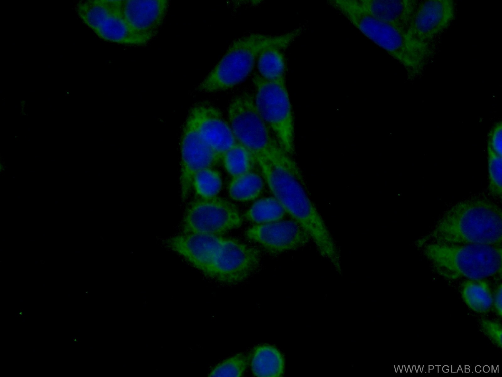 Immunofluorescence (IF) / fluorescent staining of HeLa cells using VPS26B Polyclonal antibody (15915-1-AP)