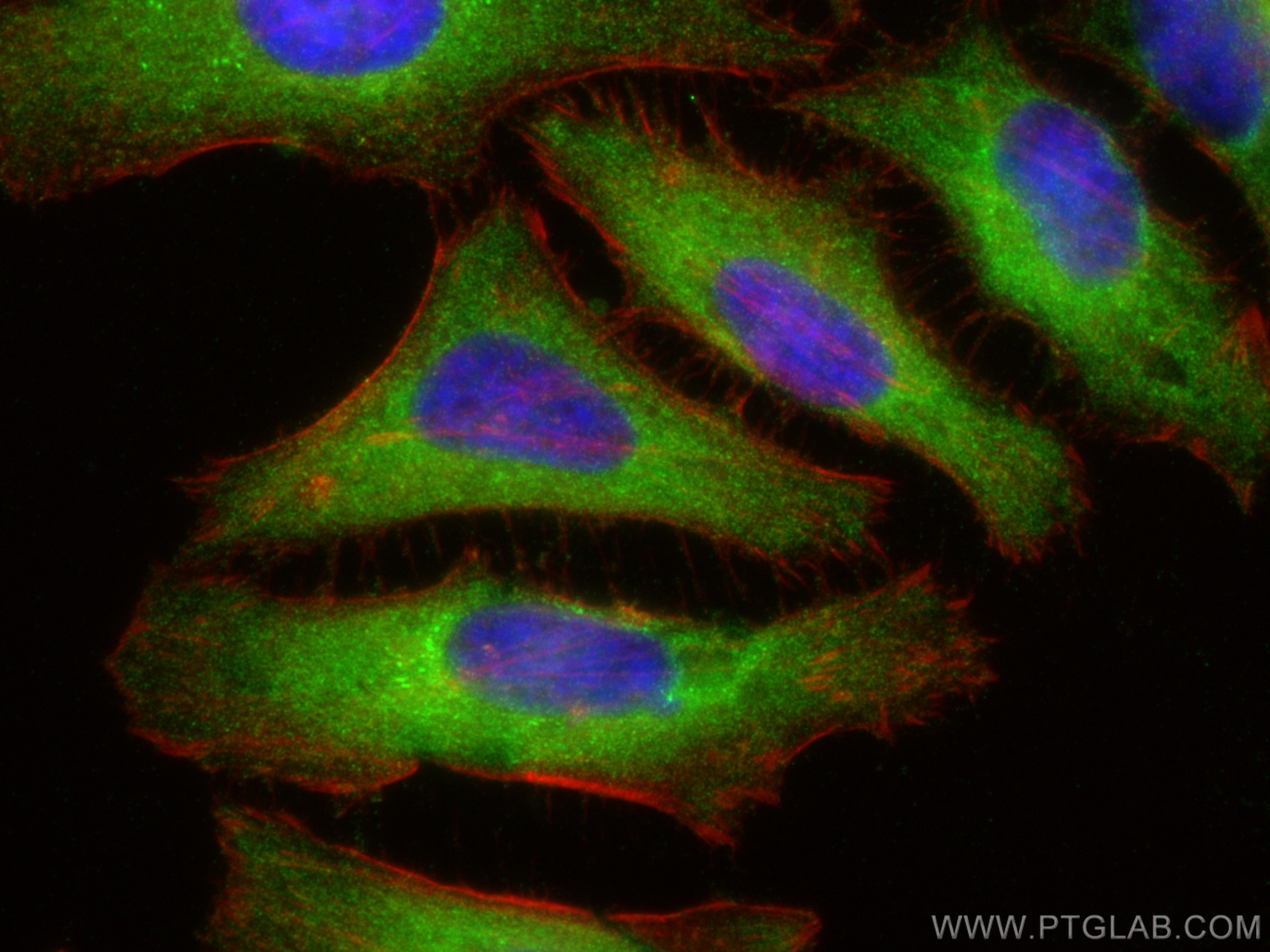 Immunofluorescence (IF) / fluorescent staining of HeLa cells using VPS26B Polyclonal antibody (15915-1-AP)