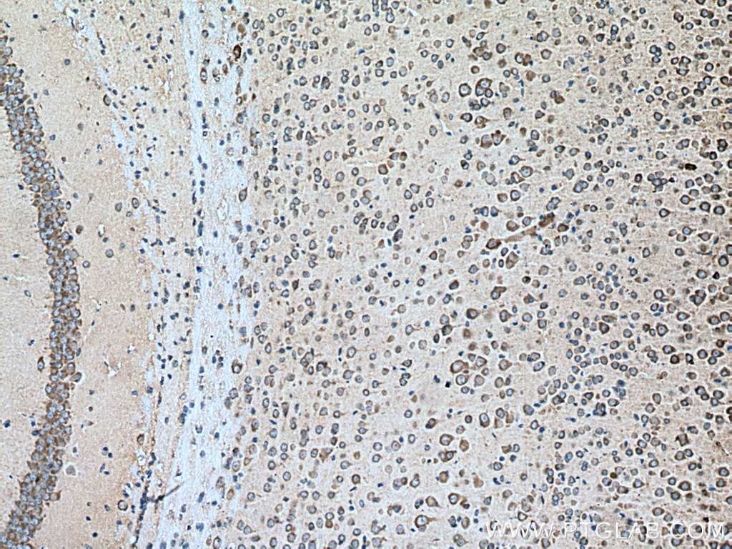 Immunohistochemistry (IHC) staining of mouse brain tissue using VPS26B Polyclonal antibody (15915-1-AP)