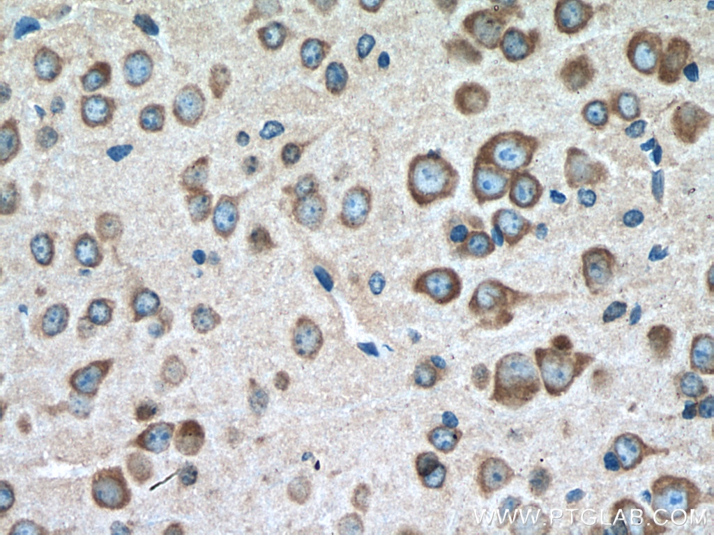 Immunohistochemistry (IHC) staining of mouse brain tissue using VPS26B Polyclonal antibody (15915-1-AP)