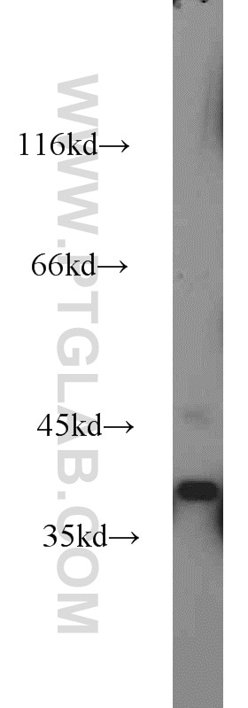 Western Blot (WB) analysis of human brain tissue using VPS26B Polyclonal antibody (15915-1-AP)