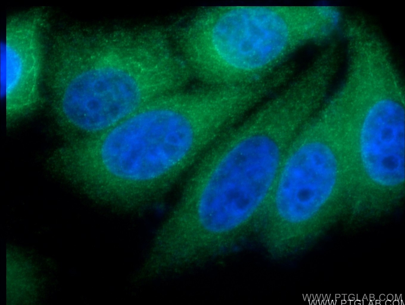 Immunofluorescence (IF) / fluorescent staining of HepG2 cells using VPS28 Polyclonal antibody (15478-1-AP)