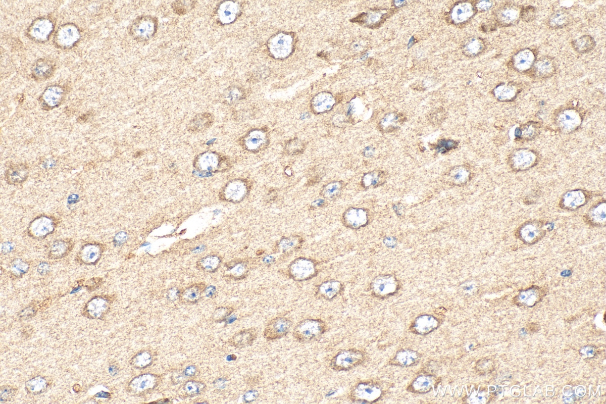 Immunohistochemistry (IHC) staining of mouse brain tissue using VPS28 Polyclonal antibody (15478-1-AP)