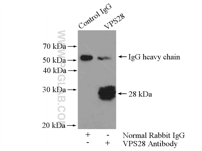 Immunoprecipitation (IP) experiment of mouse brain tissue using VPS28 Polyclonal antibody (15478-1-AP)