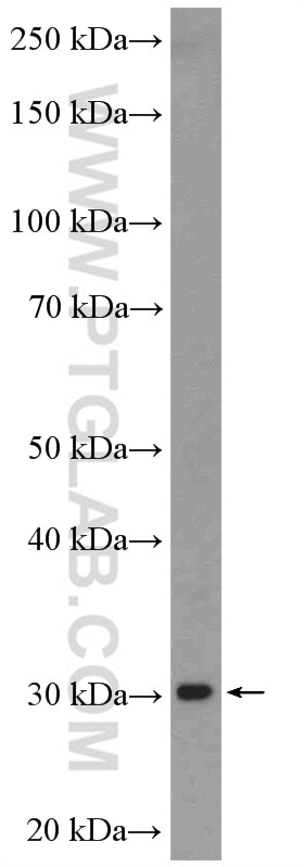 Western Blot (WB) analysis of mouse brain tissue using VPS28 Polyclonal antibody (15478-1-AP)