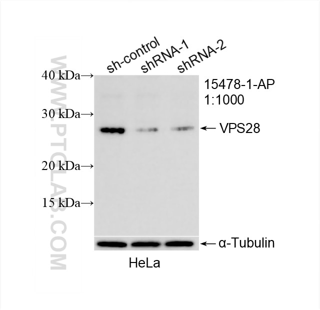 Western Blot (WB) analysis of HeLa cells using VPS28 Polyclonal antibody (15478-1-AP)
