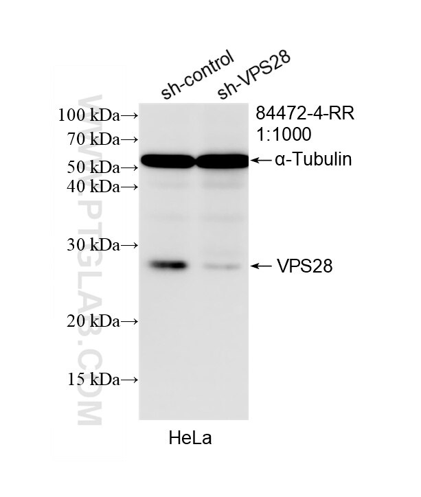 Western Blot (WB) analysis of HeLa cells using VPS28 Recombinant monoclonal antibody (84472-4-RR)