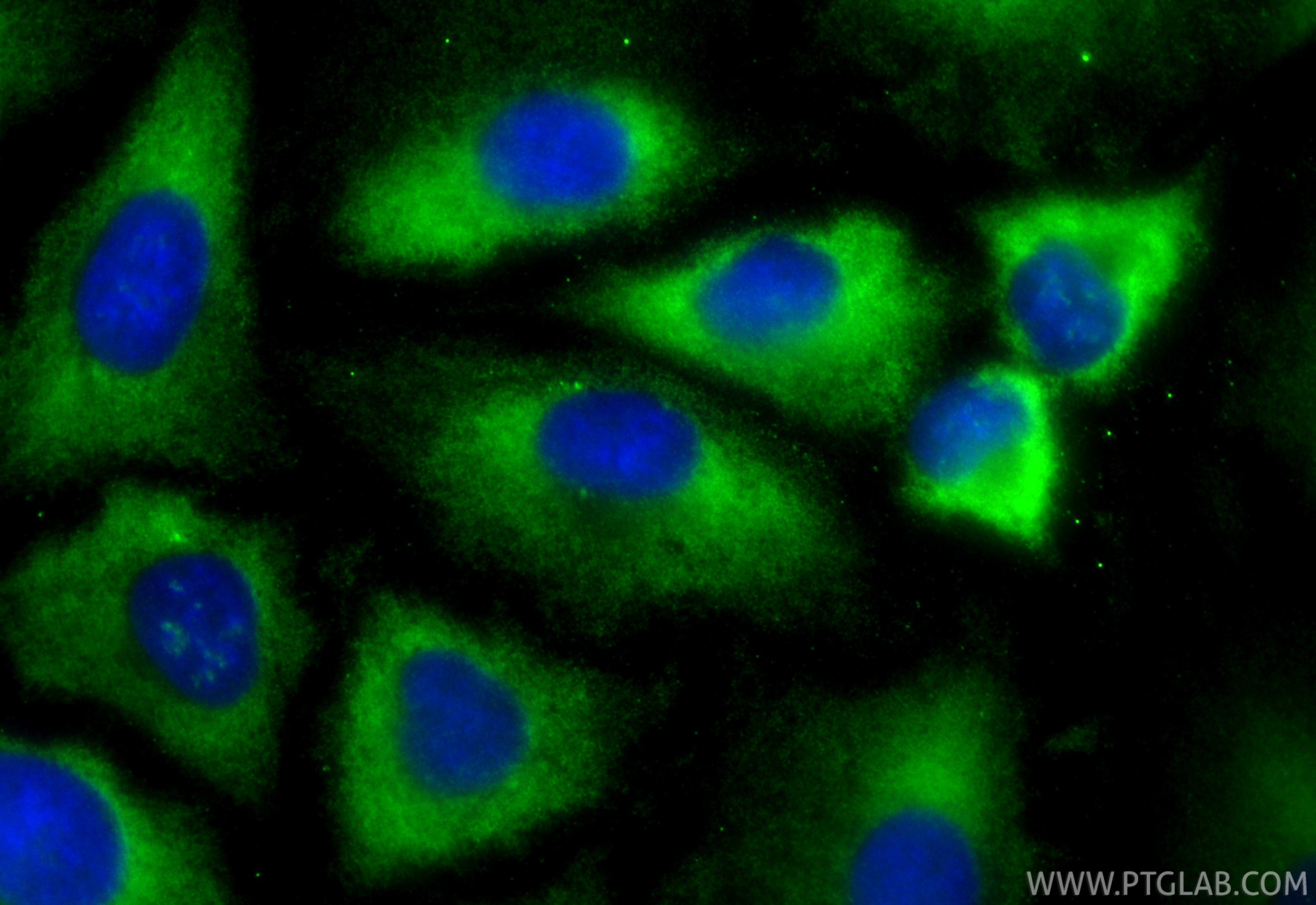 Immunofluorescence (IF) / fluorescent staining of A549 cells using CoraLite® Plus 488-conjugated VPS28 Recombinant mo (CL488-84472-4)
