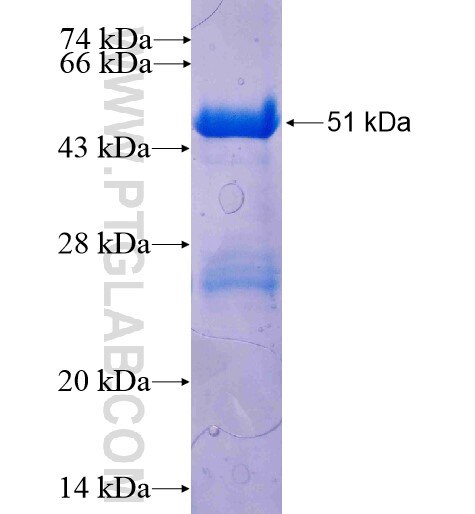 VPS28 fusion protein Ag7784 SDS-PAGE