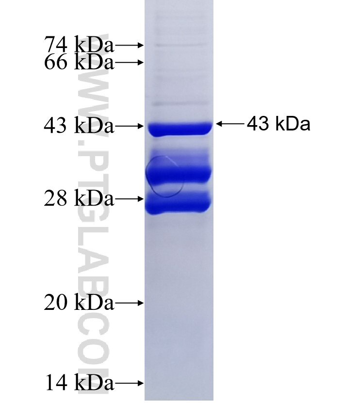 VPS29 fusion protein Ag24939 SDS-PAGE VPS29 fusion protein Ag24939 SDS-PAGE
