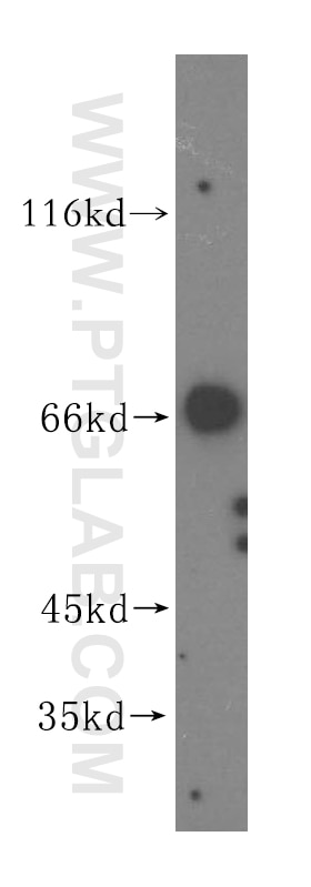 Western Blot (WB) analysis of human brain tissue using VPS33A Polyclonal antibody (16896-1-AP)