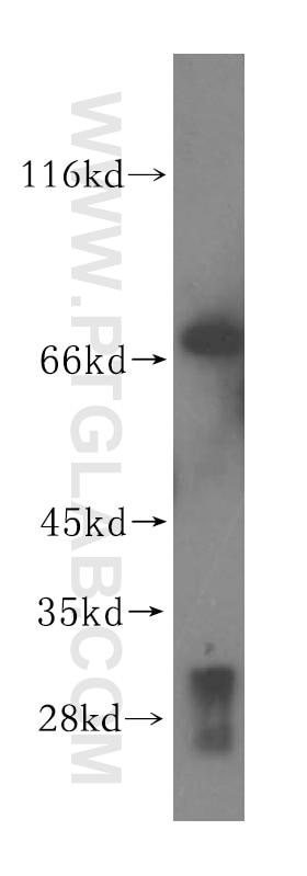 Western Blot (WB) analysis of HepG2 cells using VPS33A Polyclonal antibody (16896-1-AP)