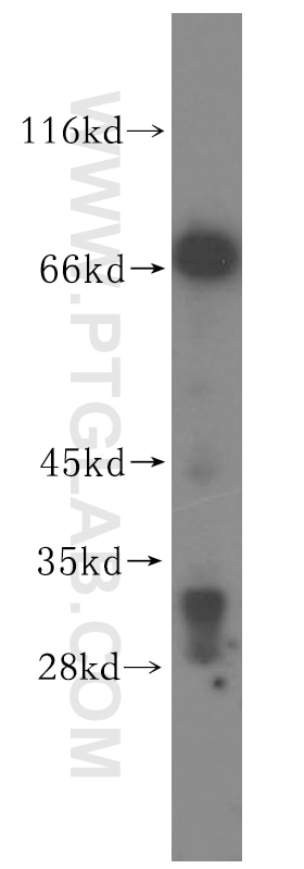 Western Blot (WB) analysis of human cerebellum tissue using VPS33A Polyclonal antibody (16896-1-AP)