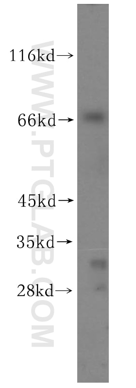Western Blot (WB) analysis of NIH/3T3 cells using VPS33A Polyclonal antibody (16896-1-AP)