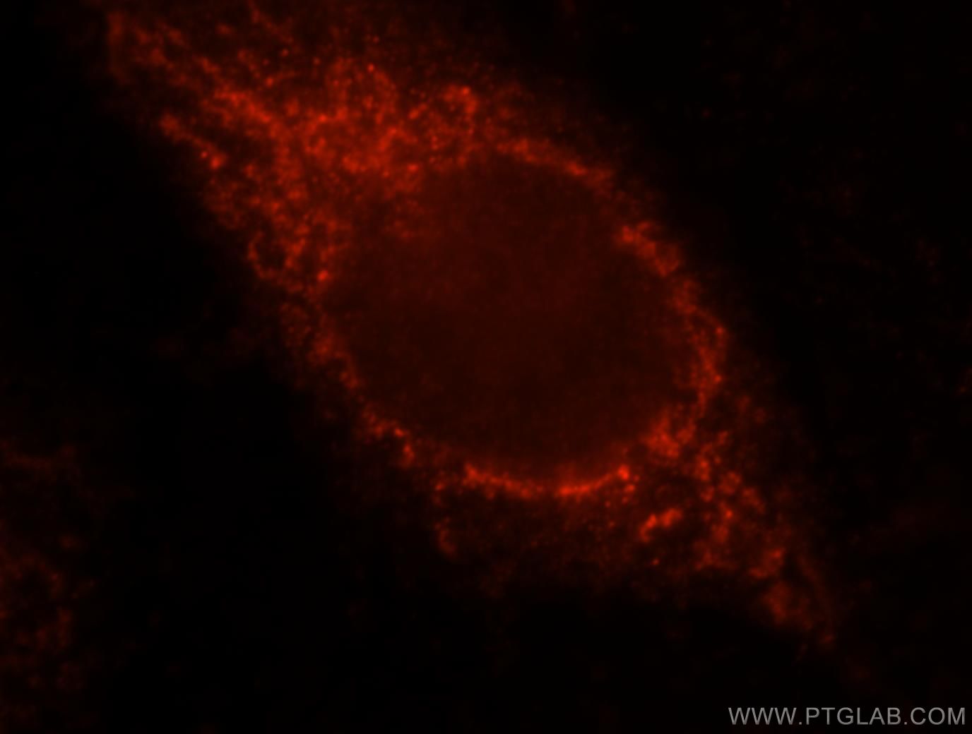 Immunofluorescence (IF) / fluorescent staining of MCF-7 cells using VPS33B Polyclonal antibody (12195-1-AP)