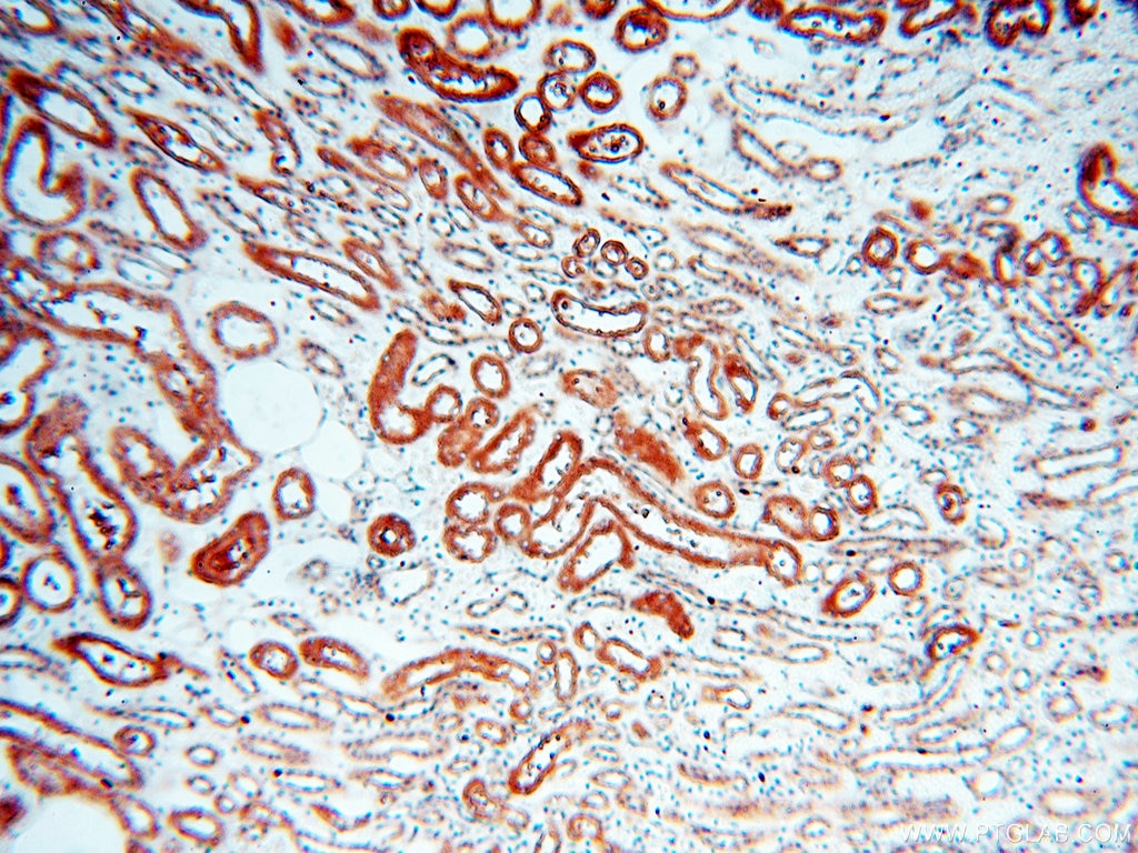 Immunohistochemistry (IHC) staining of human kidney tissue using VPS33B Polyclonal antibody (12195-1-AP)