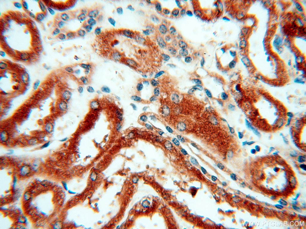 Immunohistochemistry (IHC) staining of human kidney tissue using VPS33B Polyclonal antibody (12195-1-AP)