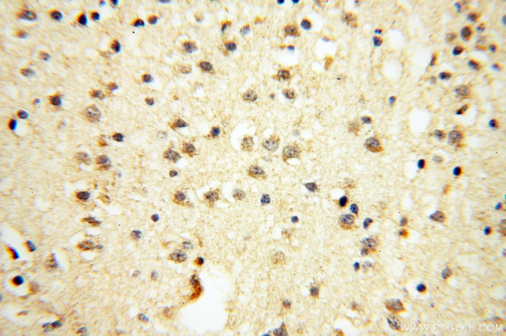 Immunohistochemistry (IHC) staining of human brain tissue using VPS33B Polyclonal antibody (12195-1-AP)
